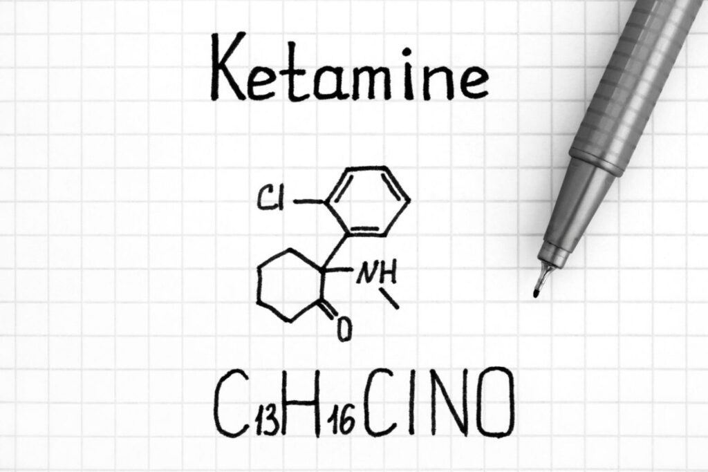 The Factors That Influence Ketamine Infusion Cost